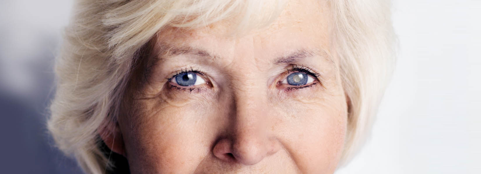 Cataract Surgery in Raymore